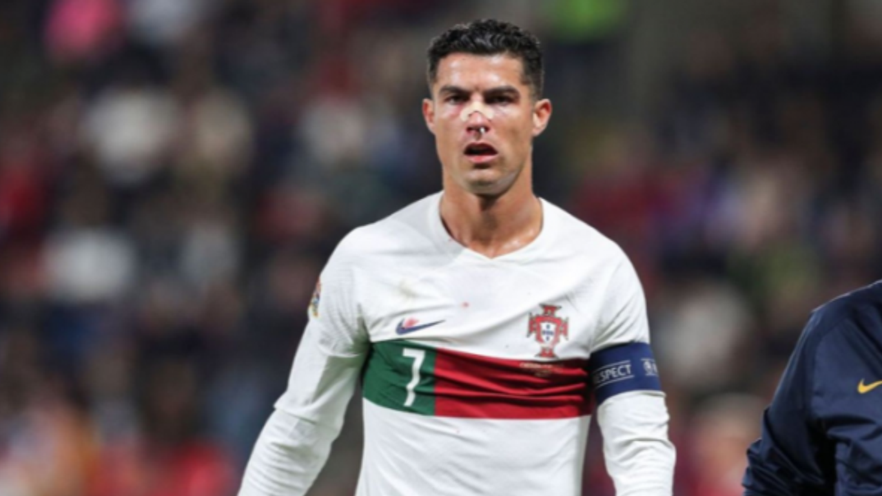 Ronaldo'nun kanlar içinde kaldığı maçta Portekiz, deplasmanda Çekya'ya acımadı: 4-0
