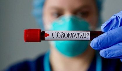 Türkiye'de koronavirüs nedeniyle toplam can kaybı sayısı kaç?