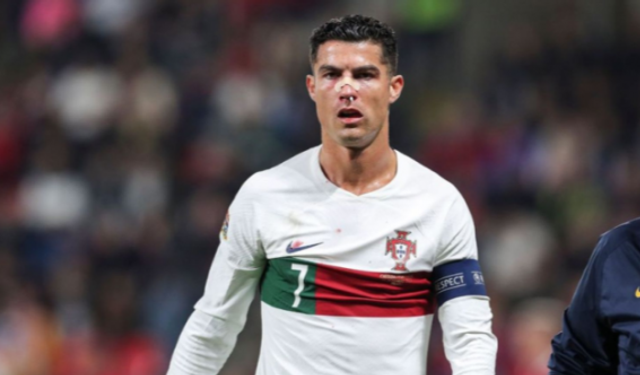 Ronaldo'nun kanlar içinde kaldığı maçta Portekiz, deplasmanda Çekya'ya acımadı: 4-0